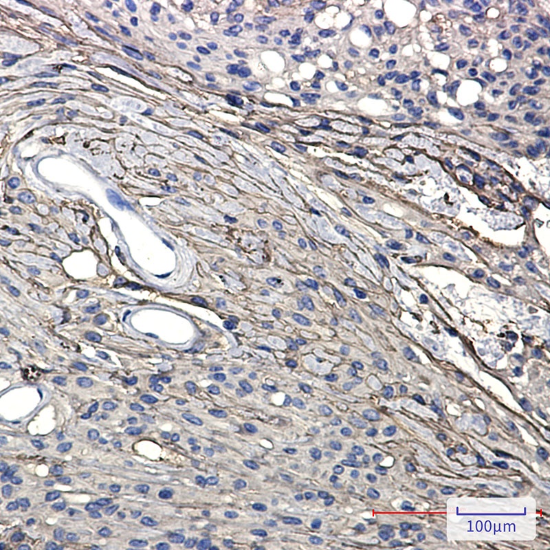 GAP43 Rabbit Monoclonal Antibody