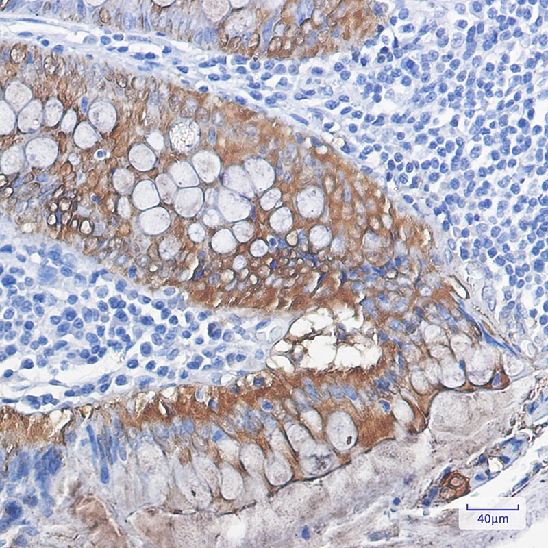 Galectin 3 Rabbit Monoclonal Antibody