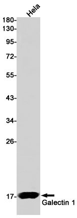 Galectin 1 Rabbit Monoclonal Antibody