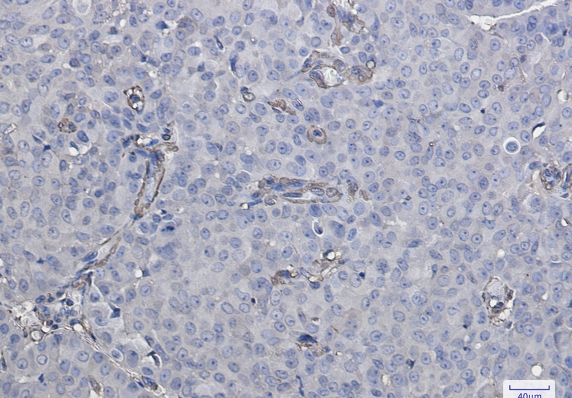 Galectin 1 Rabbit Monoclonal Antibody