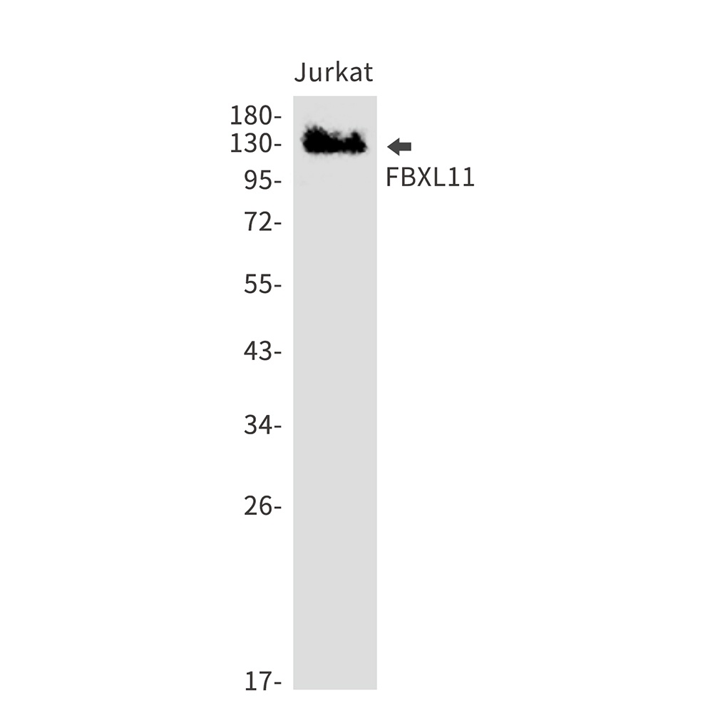 KDM2A Rabbit mAb