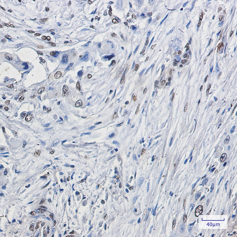 ELK1 Rabbit Monoclonal Antibody