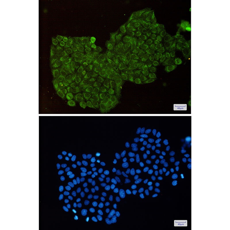 DPD Rabbit Monoclonal Antibody