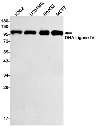 DNA Ligase IV Rabbit Monoclonal Antibody