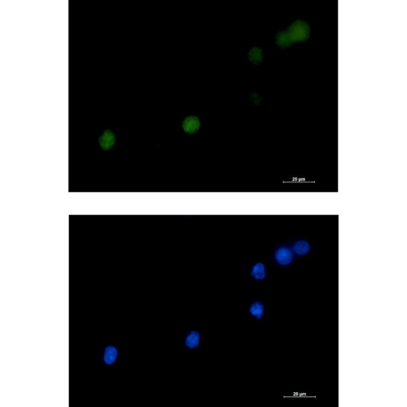 [KD] DKC1 Rabbit mAb