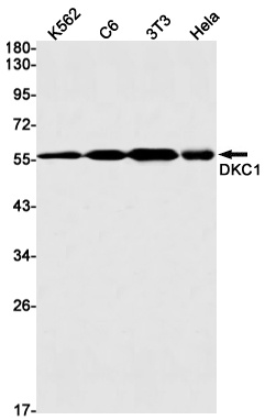 [KD] DKC1 Rabbit mAb
