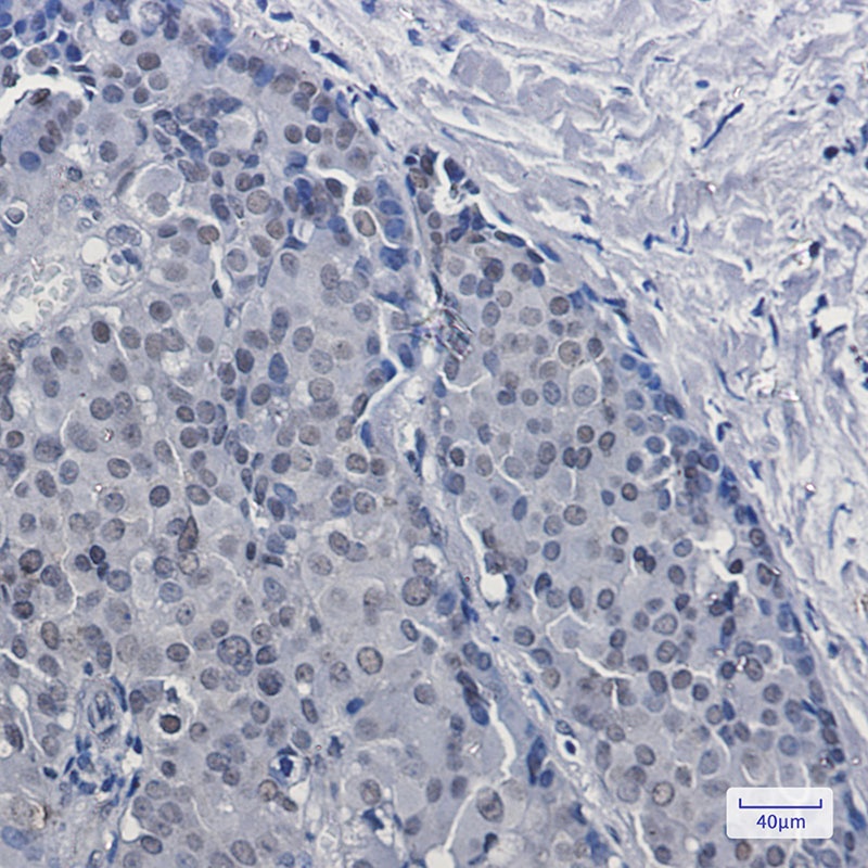 [KD] DKC1 Rabbit mAb