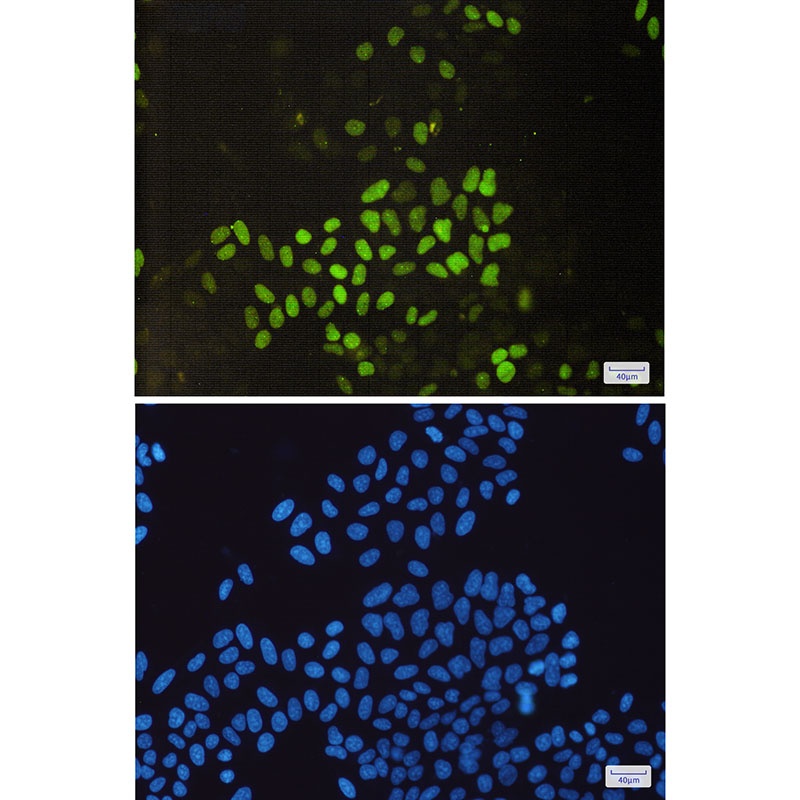 [KO] Cyclin E2 Rabbit mAb
