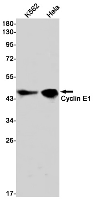 [KD] Cyclin E1 Rabbit mAb