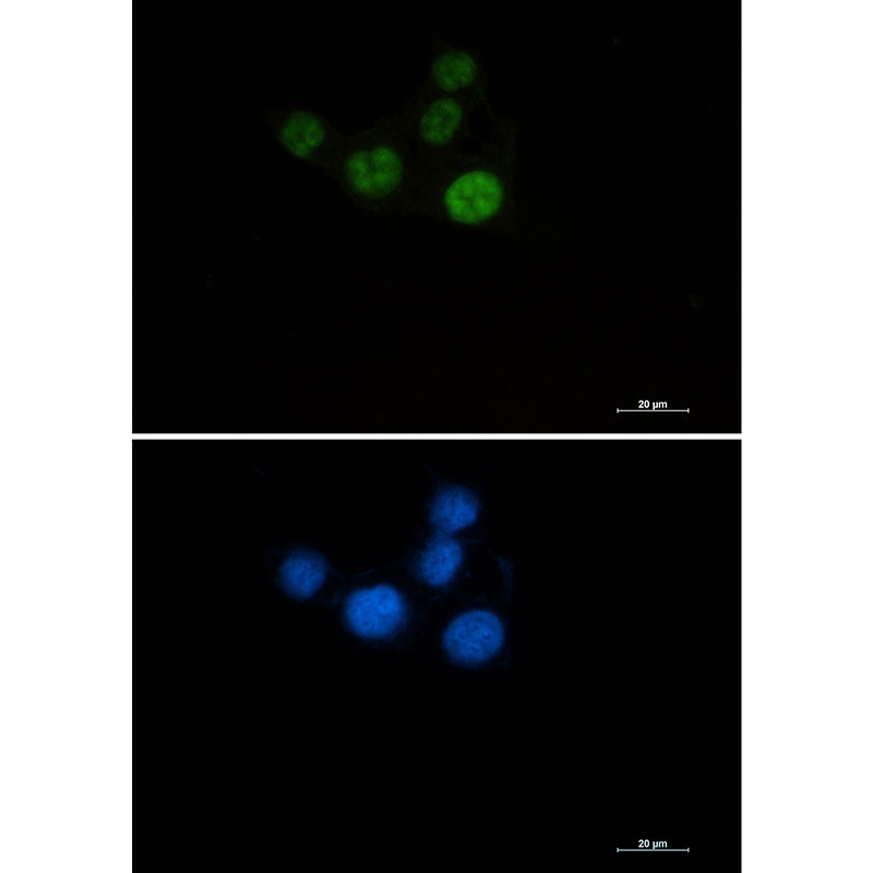 [KO] Chk2 Rabbit mAb