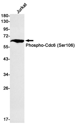 [KD] Phospho-CDC6 (Ser106) Rabbit mAb