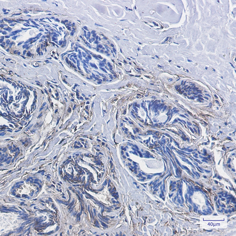 CD99 Rabbit Monoclonal Antibody