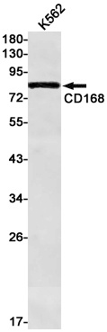 CD168 Rabbit mAb