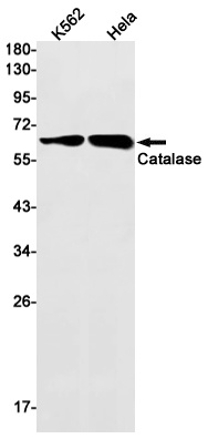[KO] Catalase Rabbit mAb