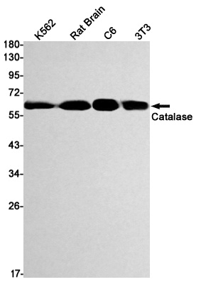 [KO] Catalase Rabbit mAb