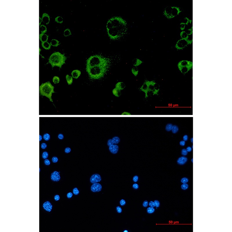 [KO] Catalase Rabbit mAb