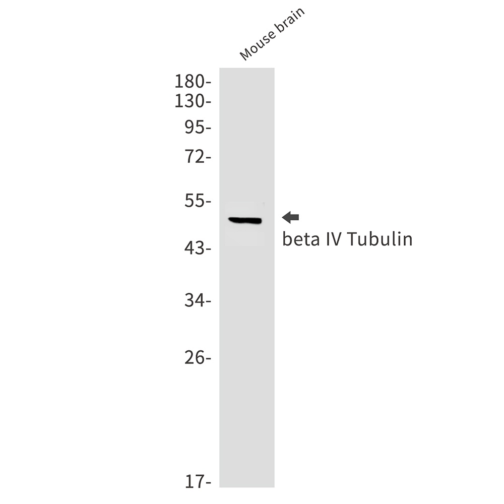 TUBB4A Antibody