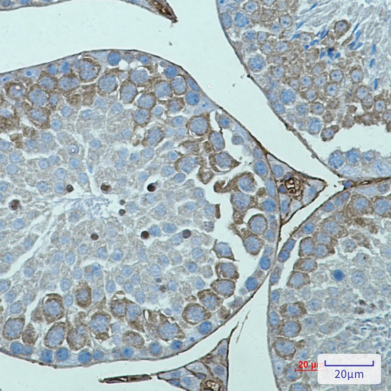 AVEN Antibody