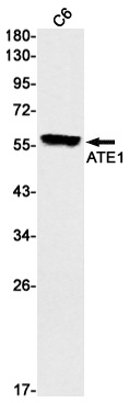 [KO] ATE1 Rabbit mAb
