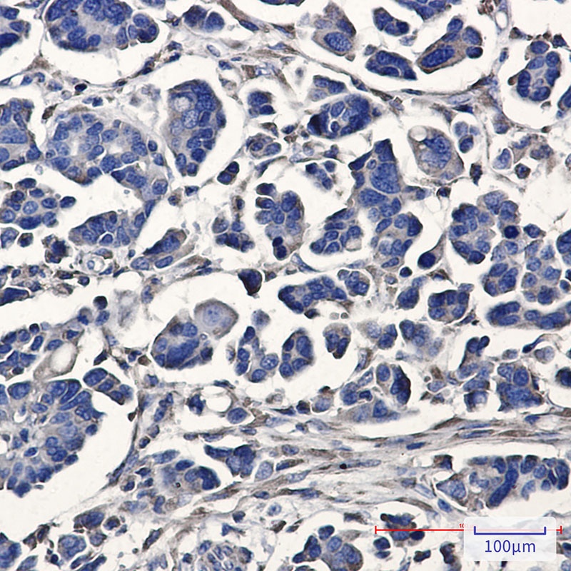 [KO] ATE1 Rabbit mAb