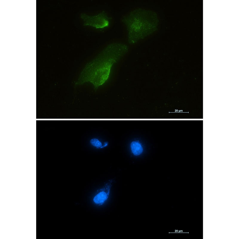 Aspartate Aminotransferase Rabbit Monoclonal Antibody