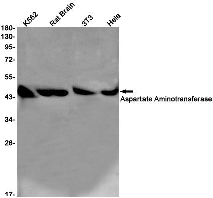 Aspartate Aminotransferase Rabbit Monoclonal Antibody