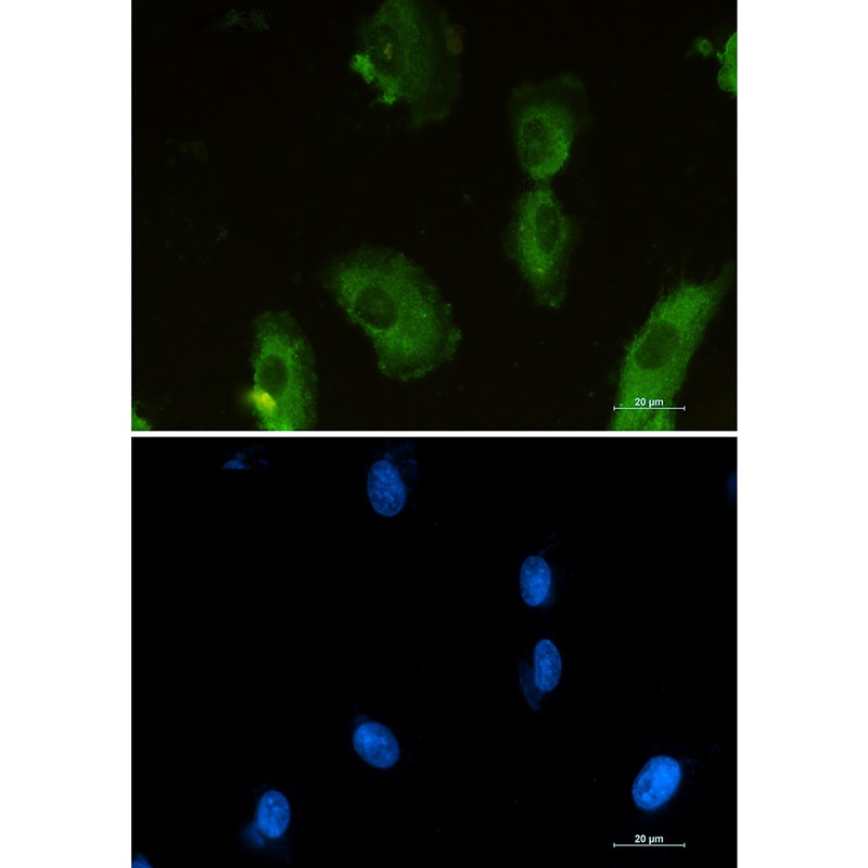 [KO] ALDOA Rabbit mAb