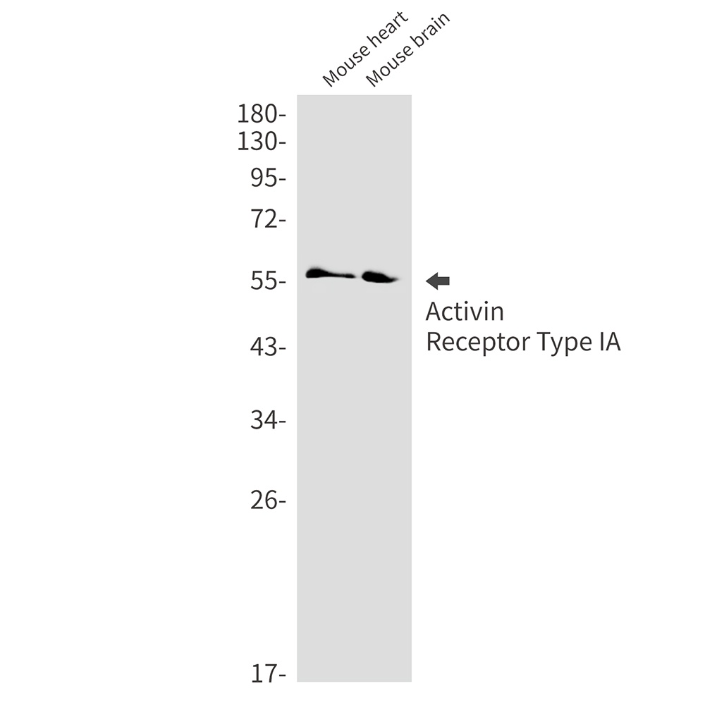 ACVR1 Rabbit Monoclonal Antibody