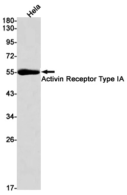 ACVR1 Rabbit Monoclonal Antibody