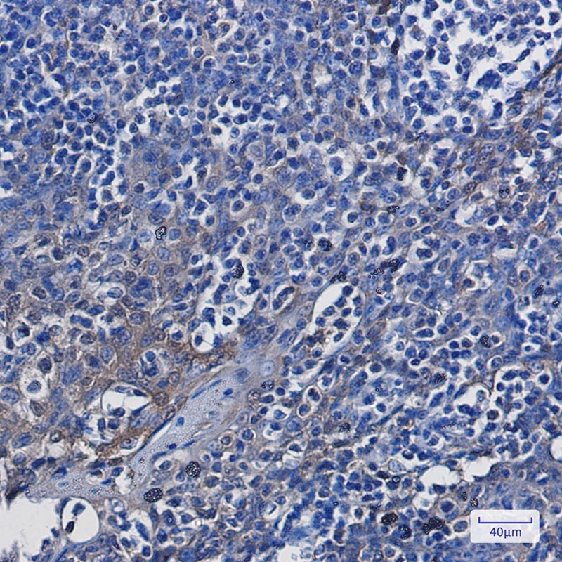 ENO1 Rabbit Monoclonal Antibody
