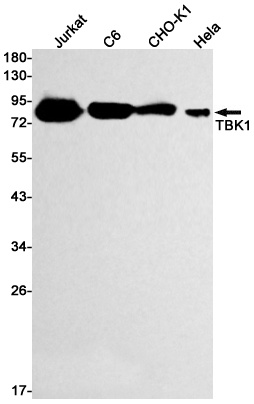 [KD] TBK1 Rabbit mAb