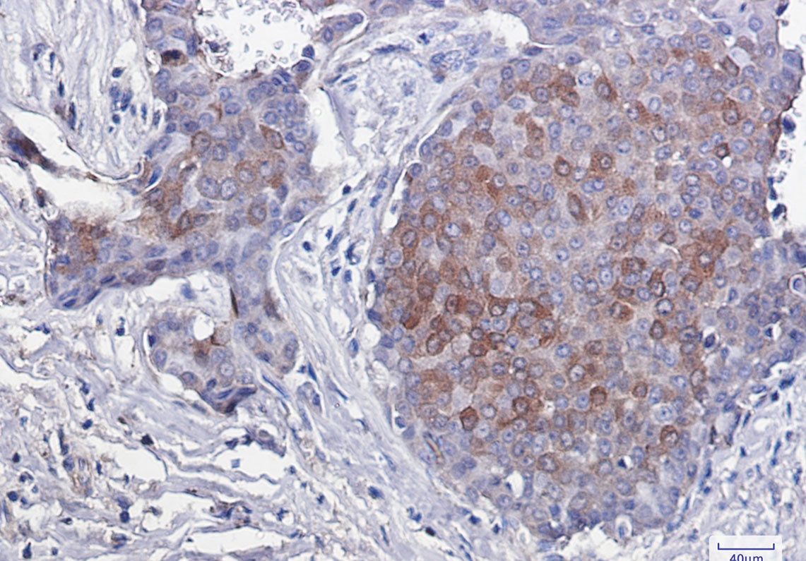[KO] Phospho-4E BP1 (Thr46) Rabbit mAb