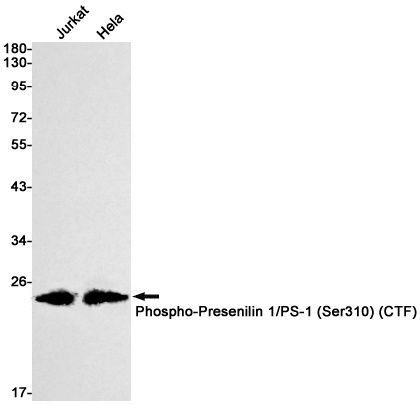 [KD] Phospho-Presenilin 1 (Ser310) Rabbit mAb
