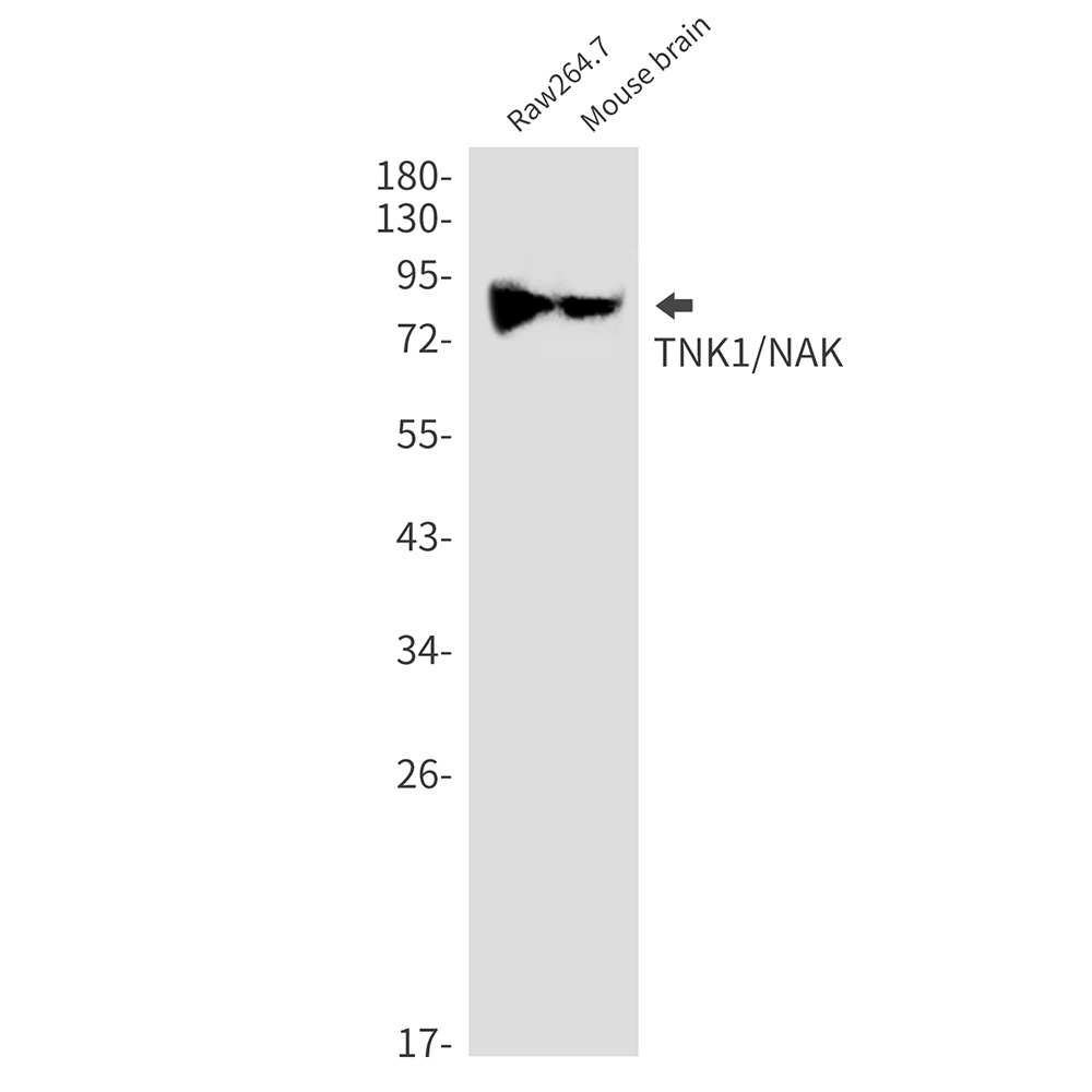 [KD] TBK1 Rabbit mAb