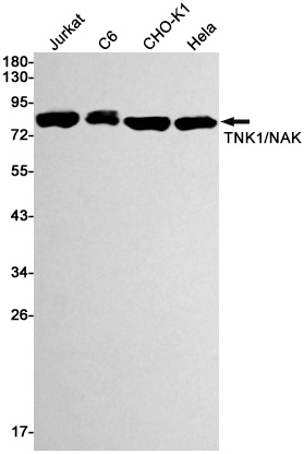 [KD] TBK1 Rabbit mAb