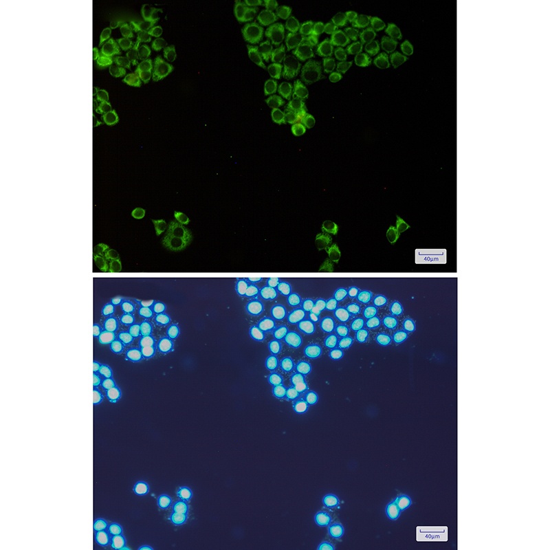 PKR Rabbit Monoclonal Antibody