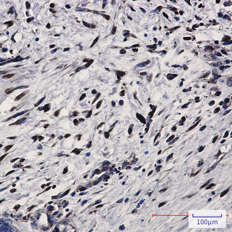 PKR Rabbit Monoclonal Antibody