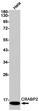 [KO] CRABP2 Rabbit mAb