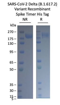 SARS-CoV-2 Delta B.1.617.2 Variant Recombinant Spike Trimer His Tag