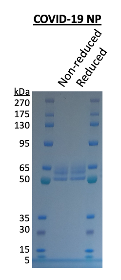 SARS-CoV-2 Nucleoprotein His Tag