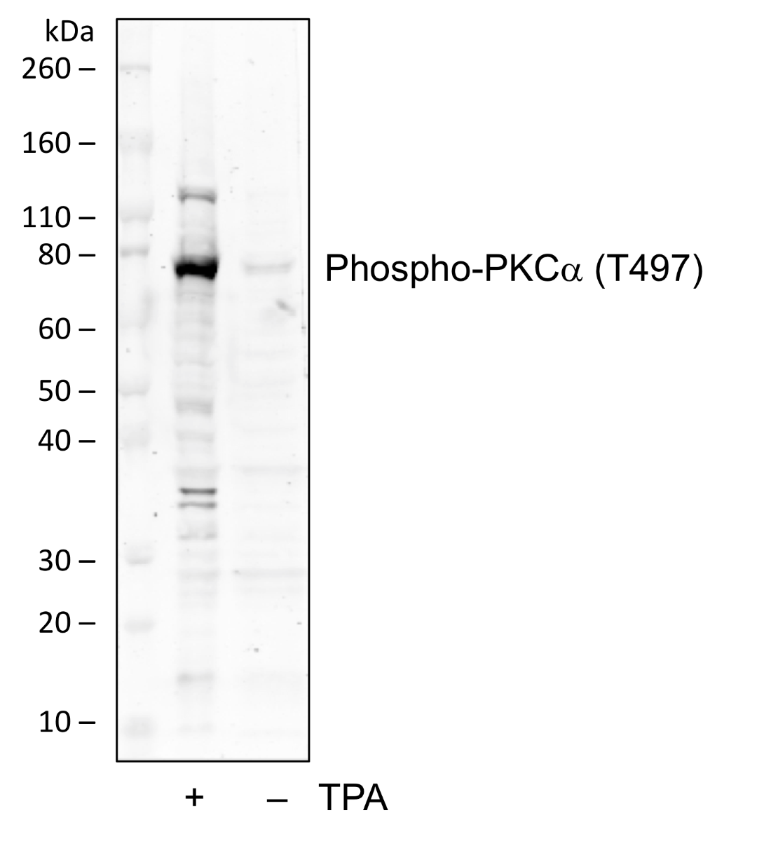 Phospho-PKCa (Thr497) (F1) rabbit mAb Antibody