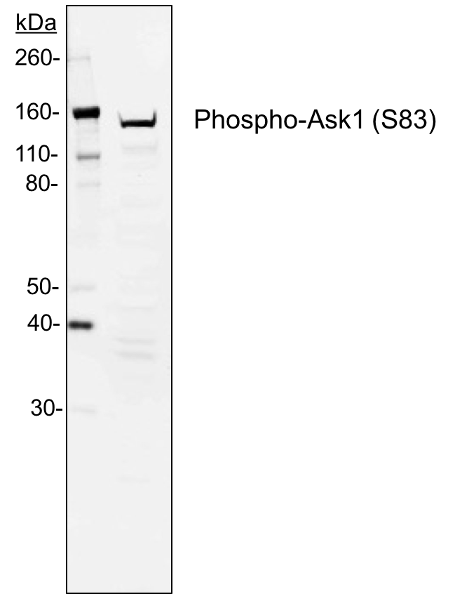 Phospho-Ask1 (Ser83) (G4) rabbit mAb Antibody