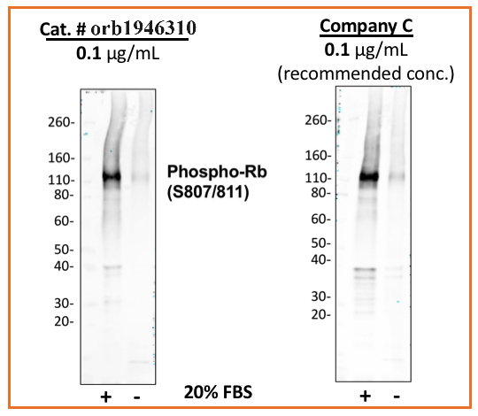 Phospho-Rb (Ser807/811) (D9) rabbit mAb Antibody
