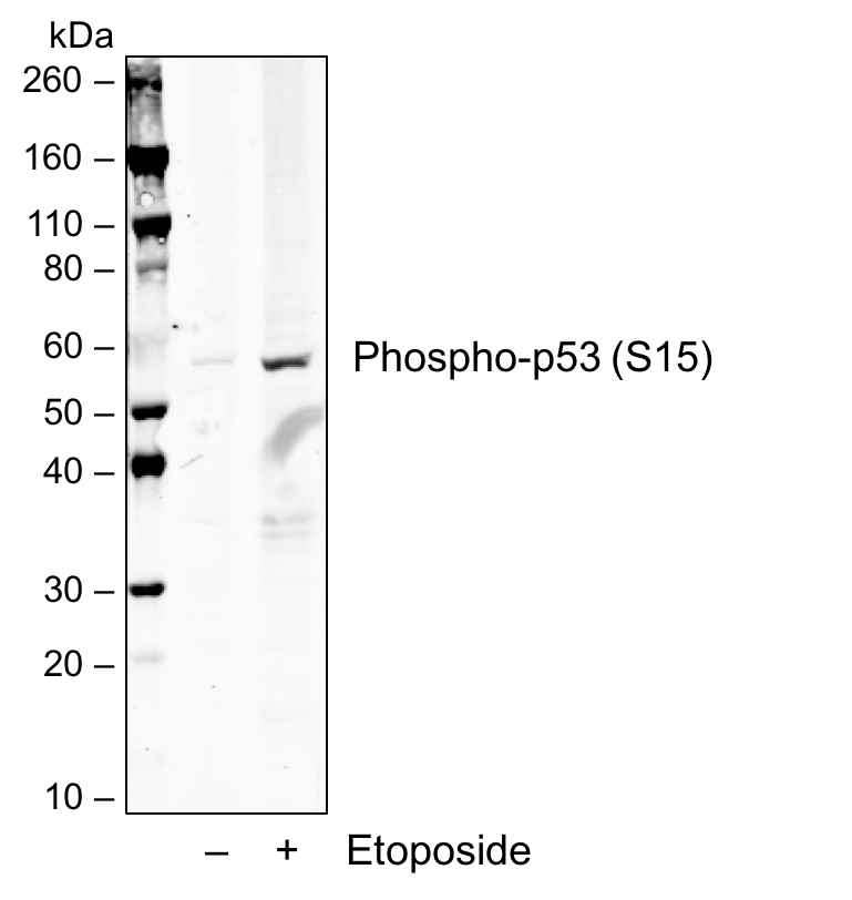 Phospho-p53 (Ser15) (1C11) rabbit mAb Antibody