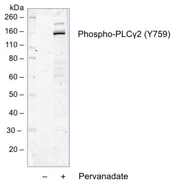 Phospho-PLCg2 (Tyr759) (G3) rabbit mAb Antibody