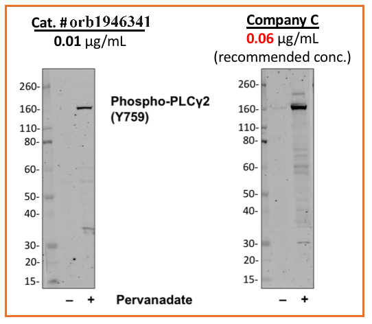 Phospho-PLCg2 (Tyr759) (G3) rabbit mAb Antibody