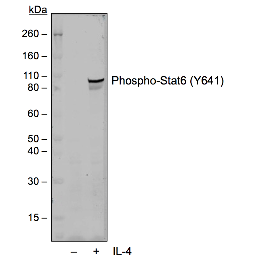 Phospho-Stat6 (Tyr641) (G12) rabbit mAb Antibody