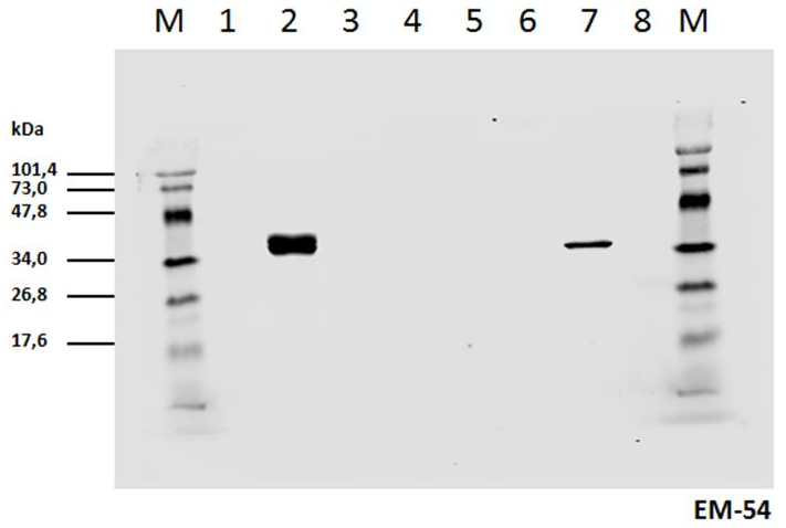 CD3 zeta (pY142) Antibody