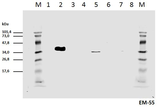 CD3 zeta (pY111) Antibody