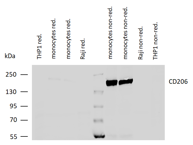 CD206 Antibody